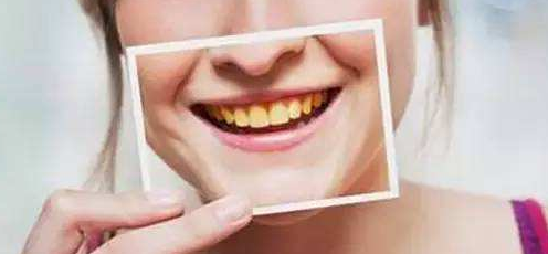 冷光美白,30分钟拥有大白牙 重庆牙科医院