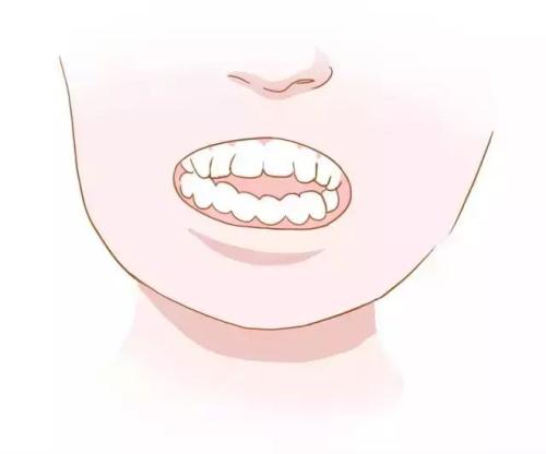 牙体磨耗怎么办? 重庆牙科医院